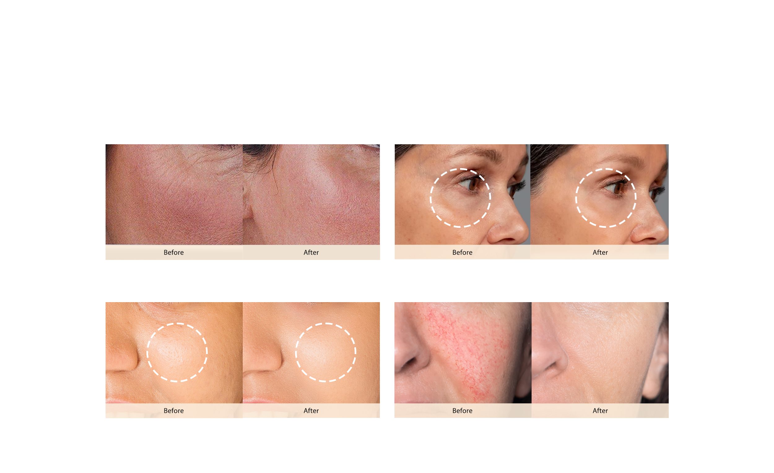 JOVS 4D Laserlichttherapie-Maske – Bild 3